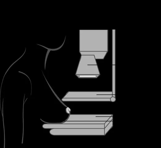 Mammography