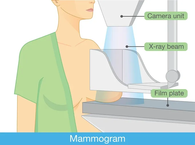 Mammography