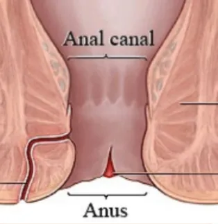 Anal