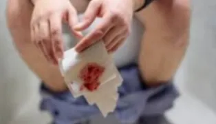 Anal
